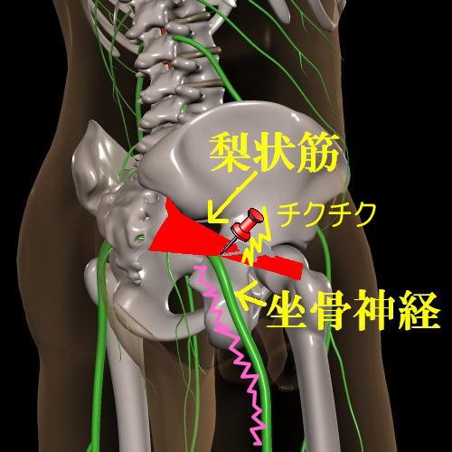 坐骨の説明画像